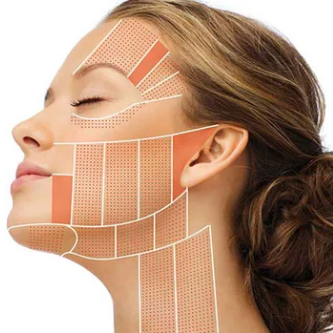 HIFU Treatment